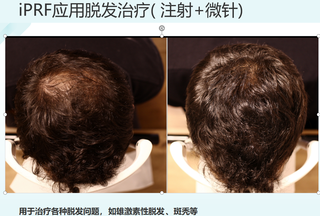 妮雀娜院线设备与认证